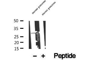 Western blot analysis of extracts of mouse pancreas tissue, using C14orf166 antibody. (C14orf166 anticorps)