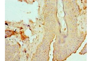 Immunohistochemistry of paraffin-embedded human skin tissue using ABIN7151878 at dilution of 1:100 (Ephrin B2 anticorps  (AA 28-229))