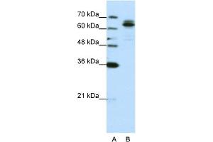 WB Suggested Anti-FXR1 Antibody Titration:  0. (FXR1 anticorps  (C-Term))