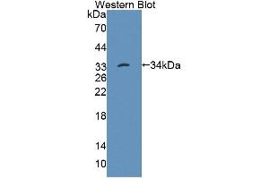 Western blot analysis of the recombinant protein. (PTPN22 anticorps  (AA 1-256))