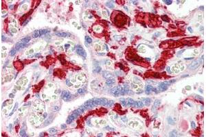 Human Placenta (formalin-fixed, paraffin-embedded) stained with F13A1 antibody ABIN461970 at 5 ug/ml followed by biotinylated secondary antibody, alkaline phosphatase-streptavidin and chromogen.