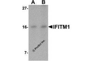 Western Blotting (WB) image for anti-Interferon-Induced Transmembrane Protein 1 (IFITM1) (C-Term) antibody (ABIN1030430) (IFITM1 anticorps  (C-Term))