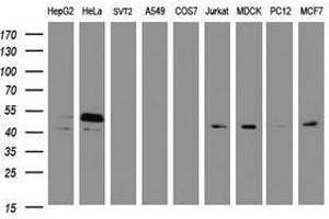Image no. 4 for anti-SERPINE1 mRNA Binding Protein 1 (SERBP1) (AA 1-262) antibody (ABIN1490678) (SERBP1 anticorps  (AA 1-262))