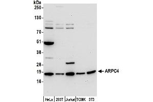 Western Blotting (WB) image for anti-Actin Related Protein 2/3 Complex, Subunit 4, 20kDa (ARPC4) (AA 1-50) antibody (ABIN7449984)