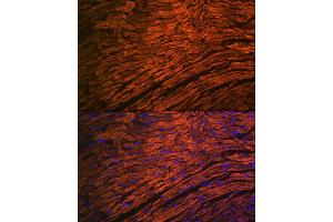 Immunofluorescence analysis of mouse heart using MYL2 Rabbit mAb (ABIN7268761) at dilution of 1:100 (40x lens). (MYL2 anticorps)