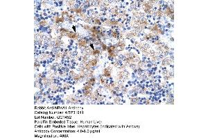 Rabbit Anti-NR4A1 Antibody  Paraffin Embedded Tissue: Human Liver Cellular Data: Hepatocytes Antibody Concentration: 4. (NR4A1 anticorps  (N-Term))