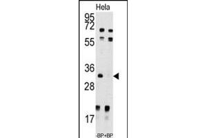 Western blot analysis of anti-UCK2 Antibody (N-term) (ABIN391286 and ABIN2841328) pre-incubated with and without blocking peptide (BP7192a) in Hela cell line lysate.