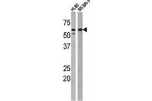 Western Blotting (WB) image for anti-Myelin Transcription Factor 1 (MYT1) (pThr495) antibody (ABIN3001766) (MYT1 anticorps  (pThr495))