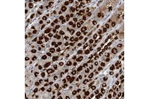 Immunohistochemical staining of human stomach with GIN1 polyclonal antibody  shows strong cytoplasmic positivity in parietal cells at 1:20-1:50 dilution. (GIN1 anticorps)