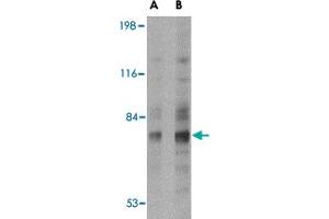 Western blot analysis of SNPH in human brain tissue lysate with SNPH polyclonal antibody  at (A) 2 and (B) 4 ug/mL . (Syntaphilin anticorps  (N-Term))