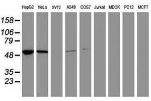 Image no. 1 for anti-Epoxide Hydrolase 1, Microsomal (Xenobiotic) (EPHX1) (AA 21-230) antibody (ABIN1491196) (EPHX1 anticorps  (AA 21-230))