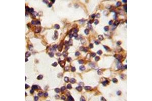IHC analysis of FFPE human lymph tissue stained with RICTOR antibody
