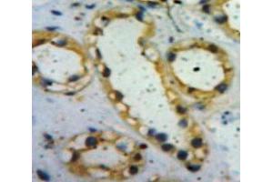 Used in DAB staining on fromalin fixed paraffin-embedded Kidney tissue (Insulin Receptor anticorps  (AA 622-945))