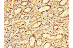 Immunohistochemistry of paraffin-embedded human renal tissue using ABIN7165680 at dilution of 1:100 (PKC alpha anticorps  (AA 495-659))