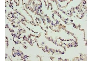 Immunohistochemistry of paraffin-embedded human lung tissue using ABIN7165213 at dilution of 1:100 (CNIH3 anticorps  (AA 94-138))