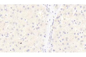 Detection of LRP6 in Human Liver Tissue using Monoclonal Antibody to Low Density Lipoprotein Receptor Related Protein 6 (LRP6) (LRP6 anticorps  (AA 981-1213))