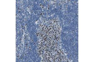 Immunohistochemical staining (Formalin-fixed paraffin-embedded sections) of human lymph node with MCM3 polyclonal antibody  shows strong nuclear positivity in reaction center cells. (MCM3 anticorps)