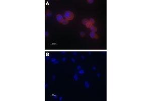Expression of TRPV5 in PC3 cells - Immunocytochemical staining of paraformaldehyde-fixed PC-3 cells with Anti-TRPV5 Antibody (ABIN7043855, ABIN7043996 and ABIN7043997), (1:100), followed by goat anti-rabbit-AlexaFluor-555 secondary antibody (A). (TRPV5 anticorps  (C-Term, Intracellular))