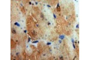 IHC-P analysis of Heart tissue, with DAB staining. (Cardiac Troponin T2 anticorps  (AA 1-295))