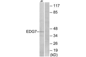 Western Blotting (WB) image for anti-Lysophosphatidic Acid Receptor 3 (LPAR3) (Internal Region) antibody (ABIN6301168) (LPAR3 anticorps  (Internal Region))