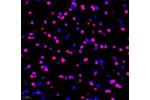 Immunofluorescence of paraffin embedded rat brain using Transketolase (ABIN7075978) at dilution of 1: 1100 (400x lens)