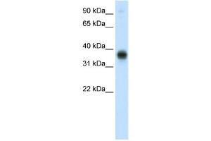 WB Suggested Anti-E2F3 Antibody Titration:  0. (E2F3 anticorps  (C-Term))