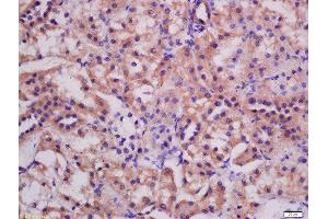 Formalin-fixed and paraffin embedded rat kidney labeled with Rabbit Anti-ATG3 Polyclonal Antibody, Unconjugated (ABIN752533) at 1:200 followed by conjugation to the secondary antibody and DAB staining (ATG3 anticorps  (AA 51-150))