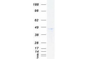 Validation with Western Blot
