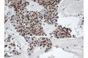 Immunohistochemistry (IHC) image for anti-alpha-1,4-N-Acetylglucosaminyltransferase (A4GNT) (AA 121-340) antibody (ABIN1490880)