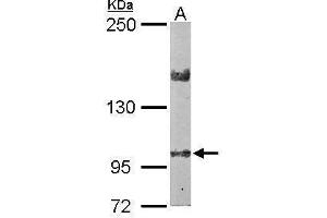 WB Image Sample (50 ug of whole cell lysate) A: Mouse brain 5% SDS PAGE antibody diluted at 1:2000