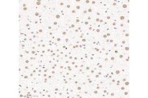 Immunohistochemistry analysis of paraffin-embedded mouse liver using,PQBP1 (ABIN7075126) at dilution of 1: 6000 (PQBP1 anticorps)