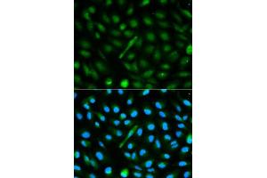Immunofluorescence analysis of MCF-7 cells using AHSG antibody.