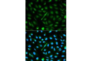 Immunofluorescence analysis of MCF-7 cells using AHSG antibody. (Fetuin A anticorps  (AA 19-300))