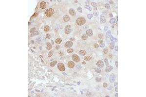 Immunohistochemistry (IHC) image for anti-Phosphate Cytidylyltransferase 1, Choline, alpha (PCYT1A) (AA 317-367) antibody (ABIN7453442) (PCYT1A anticorps  (AA 317-367))