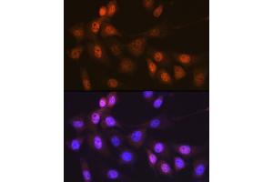 Immunofluorescence analysis of NIH-3T3 cells using Musashi-1 (MSI1) Rabbit mAb (ABIN7268700) at dilution of 1:100 (40x lens).