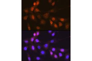 Immunofluorescence analysis of NIH-3T3 cells using Musashi-1 (MSI1) Rabbit mAb (ABIN7268700) at dilution of 1:100 (40x lens). (MSI1 anticorps)