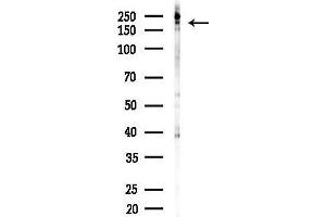 Western blot analysis of lysates from COLO205 cells(heat-shock,45 min treatment), using Phospho-NMDAR2B (Tyr1474) Antibody at 1/1000 dilution.