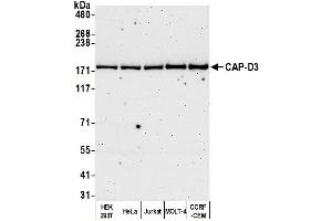 Western Blotting (WB) image for anti-Non-SMC Condensin II Complex, Subunit D3 (NCAPD3) (C-Term) antibody (ABIN7450060)