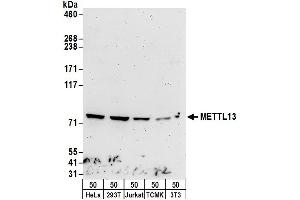 anti-Methyltransferase Like 13 (METTL13) (AA 649-699) antibody