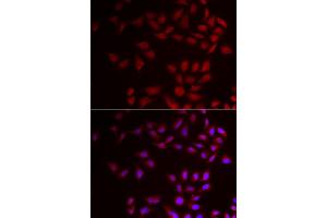 Immunofluorescence analysis of HeLa cell using CIRBP antibody. (CIRBP anticorps)