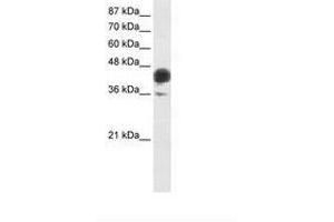 Image no. 1 for anti-Jun B Proto-Oncogene (JUNB) (AA 271-320) antibody (ABIN6736224) (JunB anticorps  (AA 271-320))