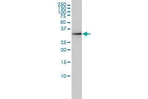 AKR7A2 monoclonal antibody (M01), clone 2A6 Western Blot analysis of AKR7A2 expression in HL-60 . (AKR7A2 anticorps  (AA 1-330))