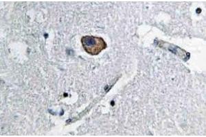 Immunohistochemistry analysis of CD171 / L1CAM Antibody in paraffin-embedded human brain tissue. (L1CAM anticorps)