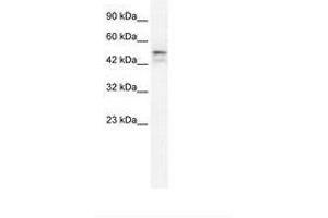 Image no. 2 for anti-One Cut Homeobox 2 (ONECUT2) (AA 293-342) antibody (ABIN202641) (ONECUT2 anticorps  (AA 293-342))