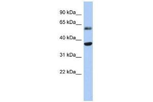 RDH10 antibody used at 1 ug/ml to detect target protein. (RDH10 anticorps)