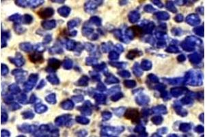 Immunohistochemistry analysis of paraffin-embedded mouse spleen using,NK-p44 (ABIN7074779) at dilution of 1: 500 (NKp44/NCR2 anticorps)