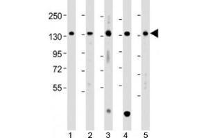 Western blot testing of human 1) A431, 2) HCT116, 3) Jurkat, 4) K562 and 5) U-2OS cell lysate with TACC3 antibody at 1:2000. (TACC3 anticorps  (AA 317-350))