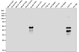 All lanes use the Antibody at 1:1W dilution for 1 hour at room temperature.