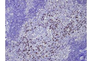 Immunohistochemistry (IHC) image for Rabbit anti-Human IgG (AA 167-185), (Internal Region) antibody (ABIN7598781) (Lapin anti-Humain IgG (AA 167-185), (Internal Region) Anticorps)