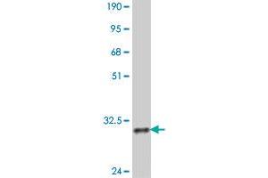 Western Blot detection against Immunogen (32.